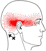 Massage For Tension Headache Relief - Morgan Massage