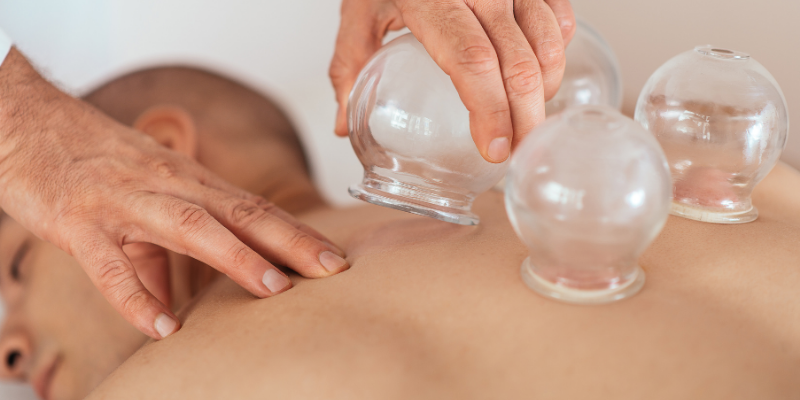 health benefits of cupping